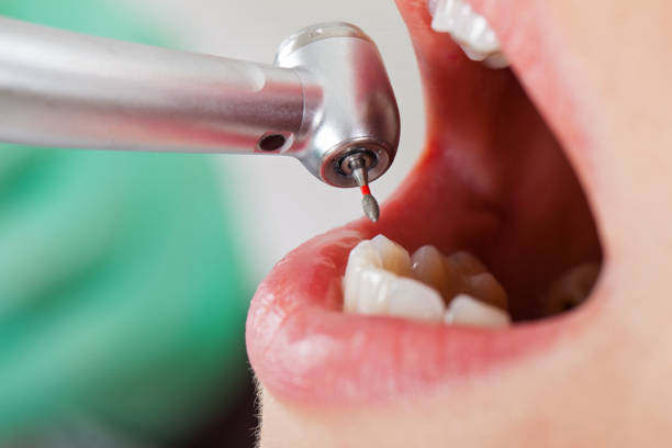 Best Emergency Dental Care for Trauma or Injury in Eustace, TX